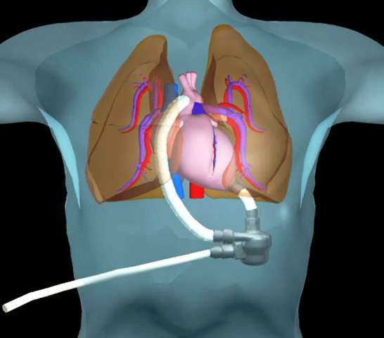 Heart Simulation